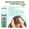 Shampoo Adiós Caspa + Ajo 100% Eficaz / Sheló Nabel