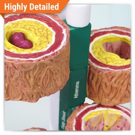 GPI Anatomicals - 4-Piece Artery Model, Replica of an Artery with Plaque for Human Anatomy and Physiology Education, Anatomy Model for Doctor's Offices and Classrooms, Medical Learning Resources