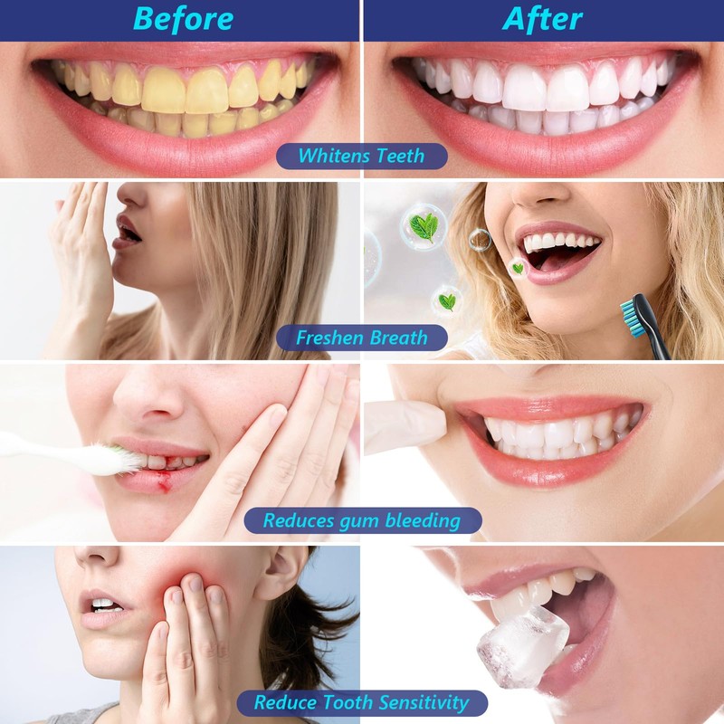 7.5% Nano Hydroxyapatite Toothpaste,6 Pack Fresh Breath Whitening Toothpaste for