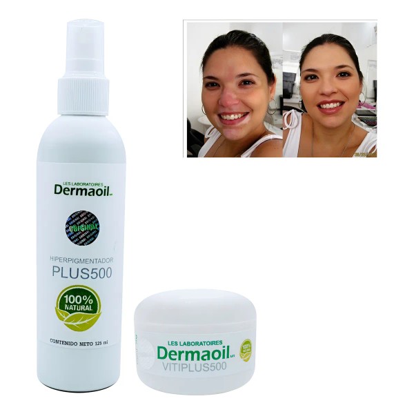 Loción Y Crema Con Melagenina Y Piperina Para Vitíligo.