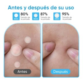 Limpiador Facial Benzacare Ph Control Antiacné 150 Ml Grasa Día/noche