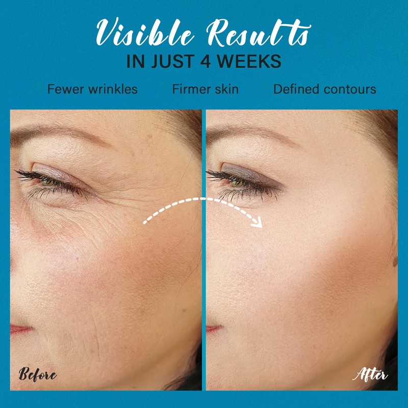 Dcsily Tighten and Lift Neck Cream: Instant Face Lift Cream