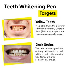 Masofta Teeth Whitening Pen with Pap+ for Yellow and Dark Stains | Peroxide & Sensitivity Free | Easy to use at Home Teeth Whitening Product Kit | 2ML