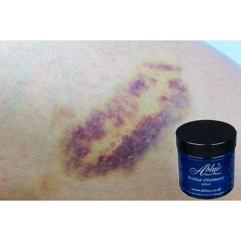 Arnica Ointment 60ml Handmade In Yorkshire