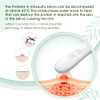 Insect Sting and Bite Relief Electronic Heat Device for After