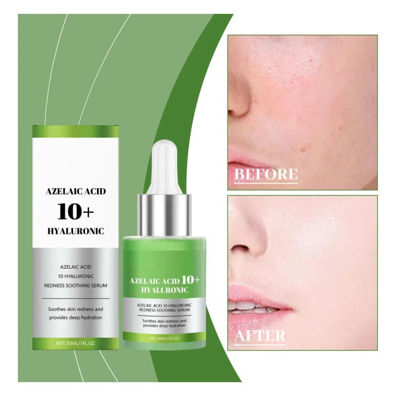 Serum Facial Hidratante Tensa Ilumina Todo Tipo Piel 30ml