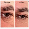 Instant Eye Bag Puffiness And Wrinkle Remover Cream For Women