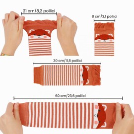 XEPST 3 Pairs Toddler Bambino Scaldamuscoli, Modello Animale Lungo Scaldamuscoli Calze al Ginocchio Protezione del Ginocchio Gamba Maniche per il Bambino Bambini Toddlers Ragazza,0-3 anni Taglia Unica