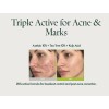 Purito Azelaic Acid 10 Kojic Tea Tree 30ml Antiacné Suero