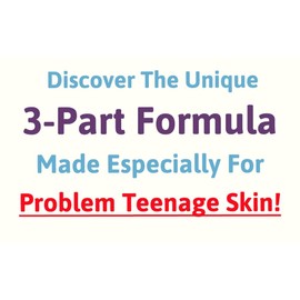 Vteen Salicylic Acid Spot Treatment Cream for Blackheads Milia Blemishes Problem and Greasy Skin Suitable and Safe for those Prone to Acne - Paraben and Cruelty FREE - 50 grams