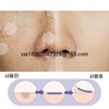 Melasma/Patches/Blemish/Freckles/Removal/Cream/Whitening/Niacinamide/Vitamin C/Whitening/1Set