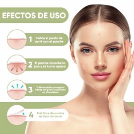 Moon & Back Parches para acné 108 Pack, Parches hidrocoloides absorbentes para tratar la erupción de acné y espinillas para el cuidado de la piel.