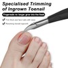 Toenail Clippers for Ingrown Toenail Tool,Toe Nail Clippers for Thick