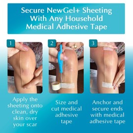 Advanced Silicone Scar Treatment Sheets for OLD, NEW Scars, Surgery, Keloids, C-Section, Burns, by NewGel Plus by MyNew Gel, 1" x 6" Sheet (4 Count) - CLEAR