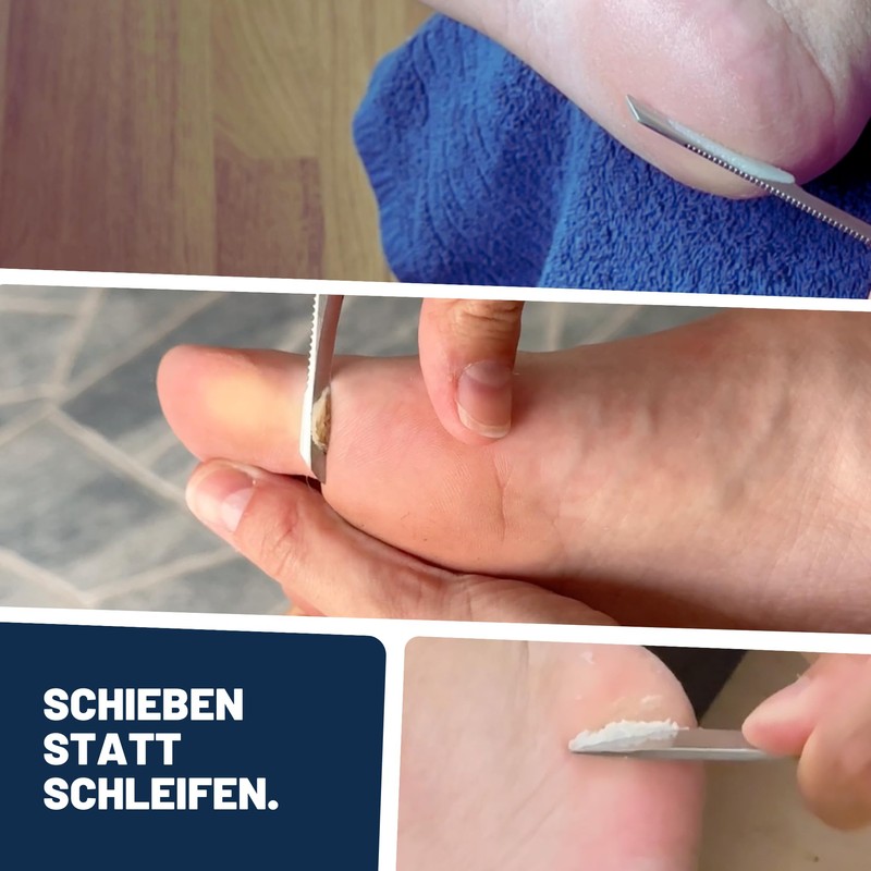 Mr. Fuss Solution No. 1-500 ml Strong Softening Callus Remover