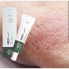 Dry skin, itchy elderly, heat rash ointment cream / 건조한피부 간지러움 노인가려움 땀띠 연고크림