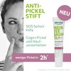 alkmene Mein Teebaumöl Anti Pickel Stift 3x 15 ml weniger