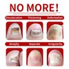 JAYSUING Ginger Nail Treatment-Vitamin E & Plant Extracts for Repairing