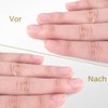 Cuticle Nippers with Cuticle Pusher, Easkep Dead Skin Remover, Scissor