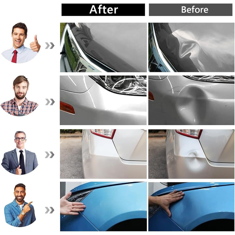YUTAOWH Dent Puller Kit, Painless Dent Removal Kit with Adjustable