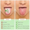 Set de 3 Limpiador de Lengua, Raspador de Lengua Acero