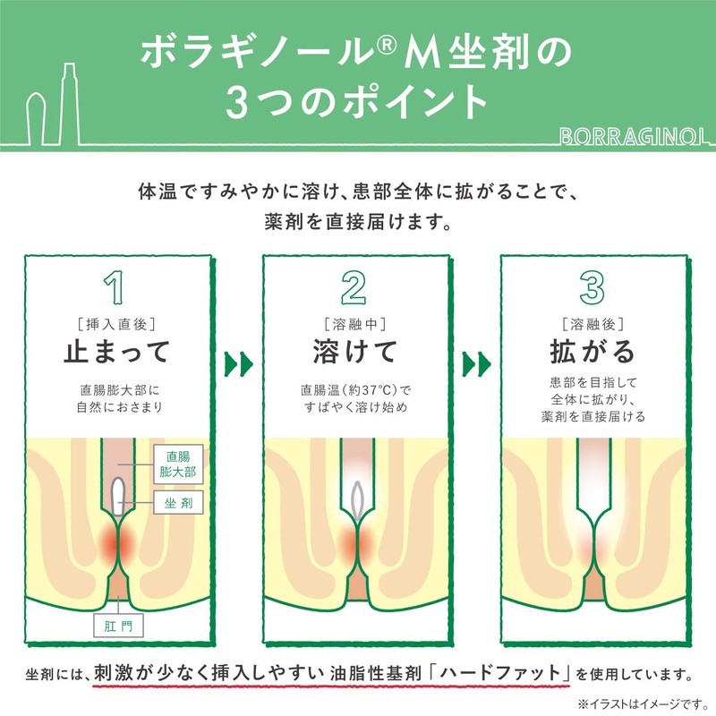 【第2類医薬品】ボラギノールM坐剤 10個