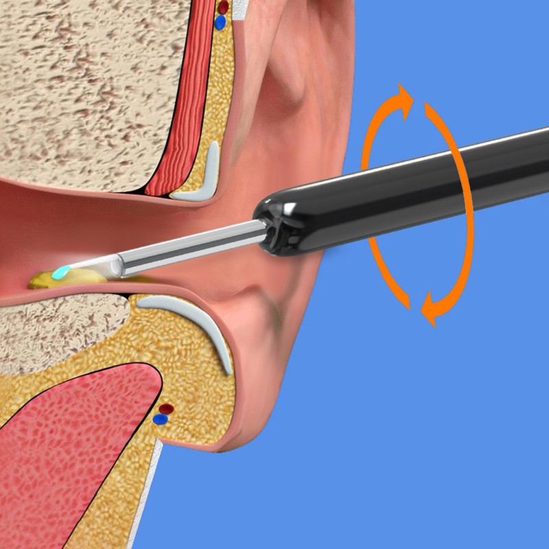 LED Light Earpick Ear Wax Removal HD Camera Visible Smart