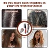 3Pcs Dandruff Comb Set, Stainless Steel Fine Tooth Psoriasis Comb,