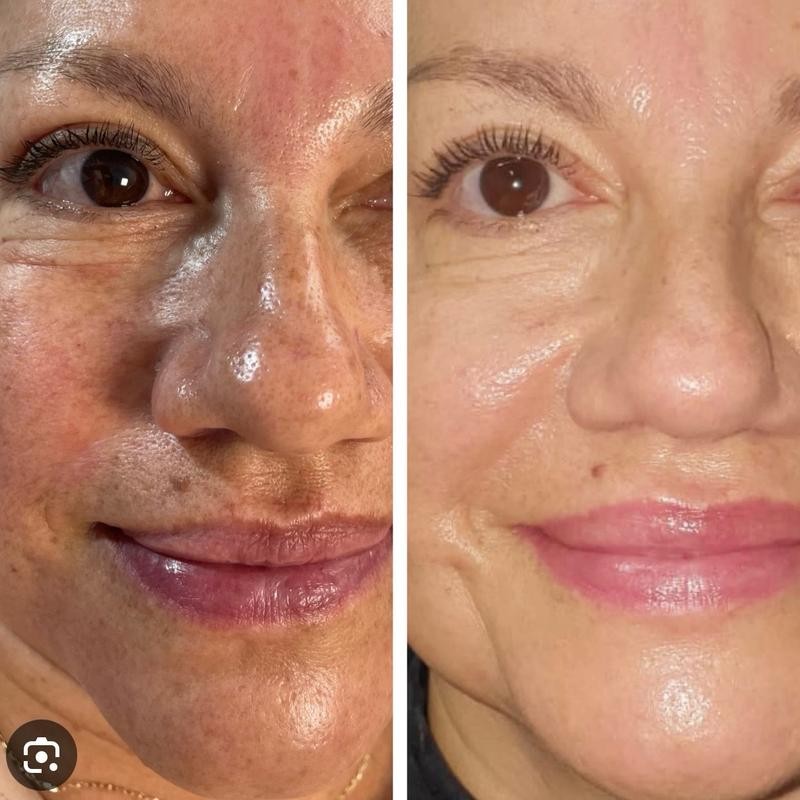 crema Carotone 135ml anti dark spot Clean Face