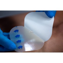 Hydrocolloid Dressing Extra Thin Sterile 15cm x 15cm (Pack of 5)