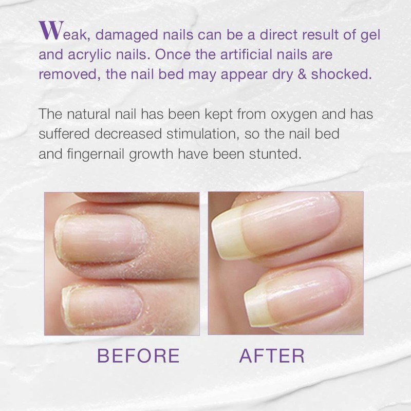 Nail Tek XTRA 4 Nail Strengthener for Weak, Damaged Nail