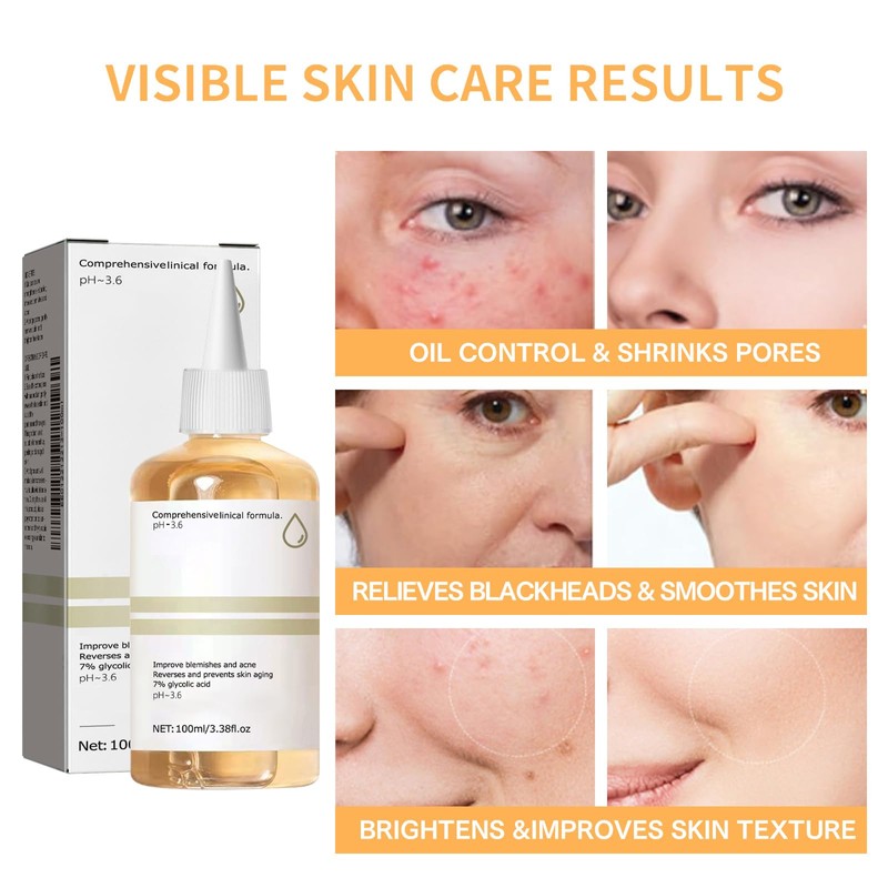 100 ml Glycolic Acid Toner, Glycolic Acid Peeling 7% Ige