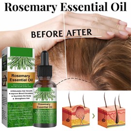 Aceite Natural de Romero para Crecimiento del Cabello Previene Caída del Cabello, Repara Cabello Dañado, Estimula Crecimiento, Cuida Cuero Cabelludo Seco
