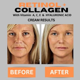 Retinol + Collagen, Hyaluronic Acid, Vitamin C Anti-Aging Face Cream, Day and Night Moisturizing Cream, Anti-Wrinkle Cream for Face, Firming Cream - 4oz