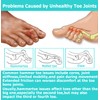 Byehambuni Hammer Toe Corrector, Hammer Toe Straighteners for Curled and