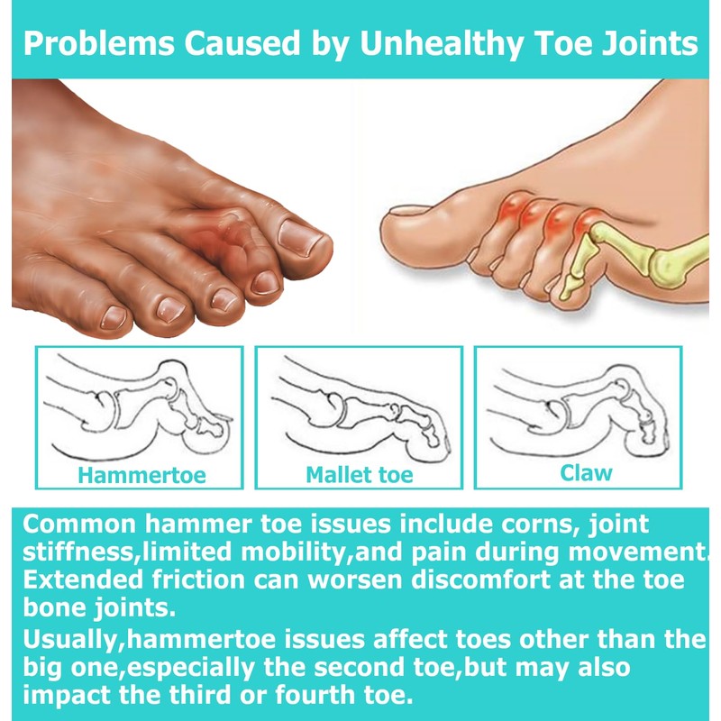 Byehambuni Hammer Toe Corrector, Hammer Toe Straighteners for Curled and