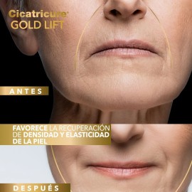 Cicatricure Crema Gold Lift Día – Resultados en 6 Semanas, Crema Antiarrugas, Mejora Elasticidad, Estimula Colágeno, con Calcio, Silicio y FPS 30, Crema Facial y Contorno de Ojos, Tarro de 50 g