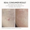 Arencia Erasor Shot 10% Glycolic Acid + BHA Exfoliating Toner