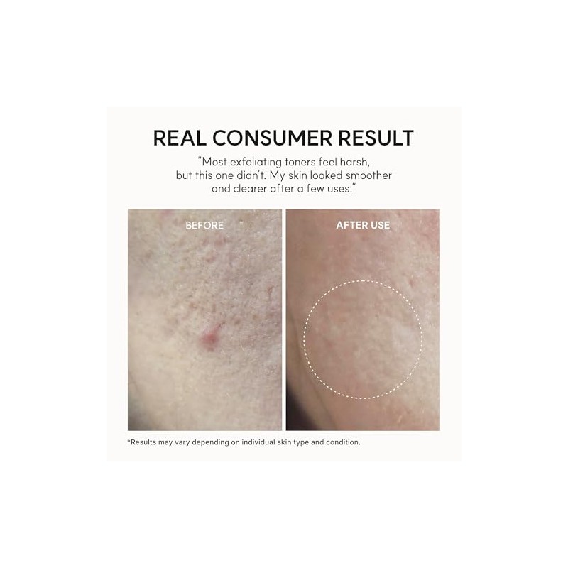 Arencia Erasor Shot 10% Glycolic Acid + BHA Exfoliating Toner