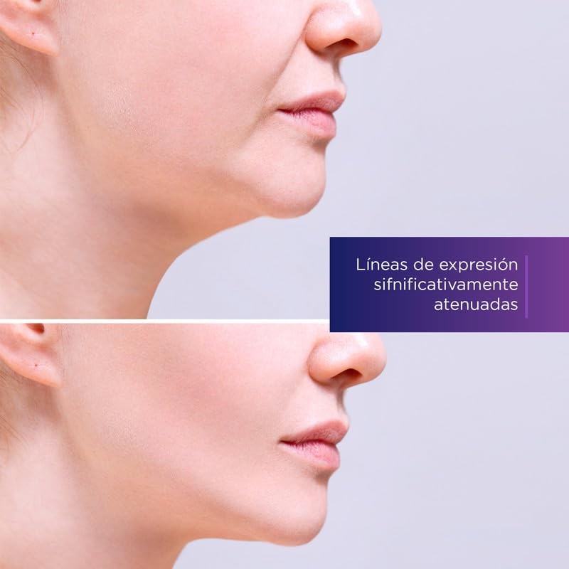 Skinvita Serum Facial Tensor De Líneas De Expresión 50ml