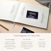 Your Edition Baby Journal - Baby Memory Book for Expecting
