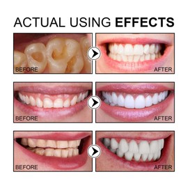 120g Sp-6 Ultra Whitening Toothpaste,Probiotics Bright White Toothpaste,Toothpaste Sp-6 Brightening,Sp-6 Toothpaste Probiotic,Deep Cleaning Teeth Whitening Toothpaste,Fresh Breath Oral Care Toothpaste