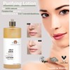 Cleansing Lotion Oily Skin with Witch Hazel and Rosemary Leaf