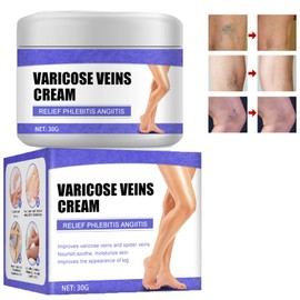 Varicose Veins Cream, Varicose Veins Cream, Cream Against Spider Veins, Varicose Veins and Spider Veins Removal, Legs Care Cream, Gentle Leg Care, Improve Blood Circulation