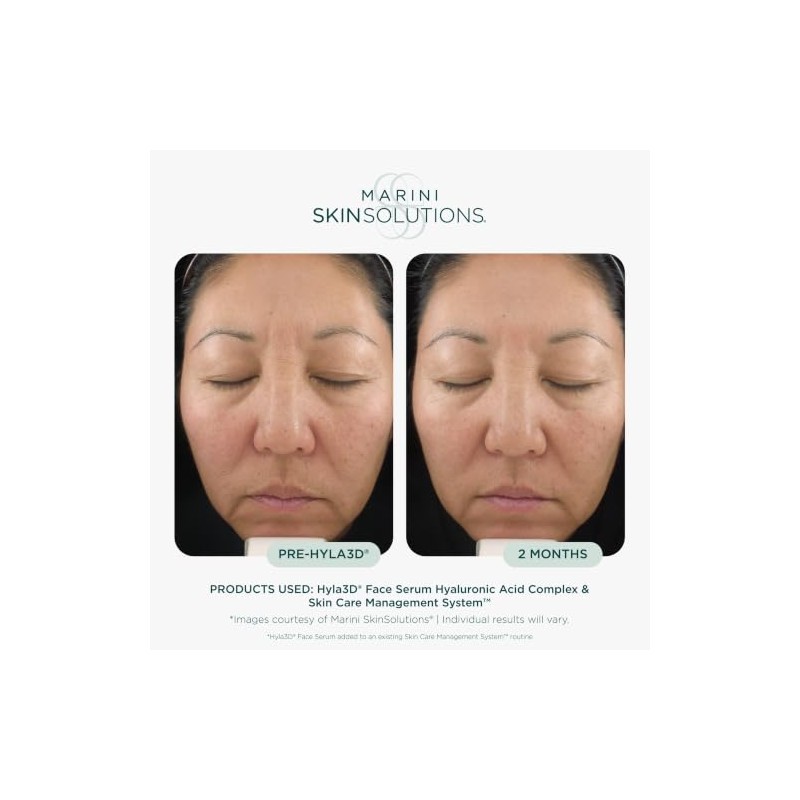 Marini SkinSolutions Hyla3D Sérum Facial - Sérum Ligero e Hidratante