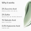 The INKEY List Succinic Acid Treatment 15ml
