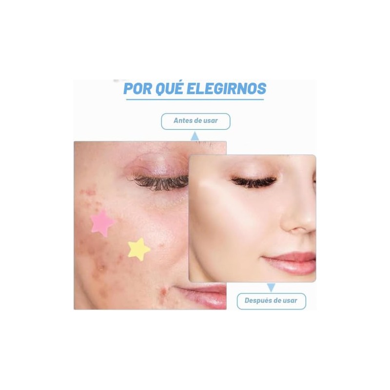 Mydear 480 Parches Acné Hidrocoloides Espinillas Calcomanías Ultra Finas Cara