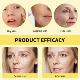 VARKAGE 2 Stück 30 ml Frankincense Oil Organic, Weihrauchöl Bio für Haut, Jojoba Oil, Verstärkendes Anti Falten Serum