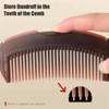 Dandruff Comb & Lice Comb with Handle - Hollow Tooth
