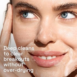 Cetaphil Acne Face Wash, Gentle Clear Clarifying Acne Cream Cleanser with 2% Salicylic Acid, Deep Cleans & Treats Acne Prone Skin, Skin Care for Sensi